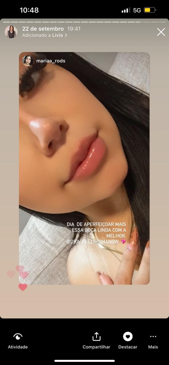 depoimento preenchimento labial1